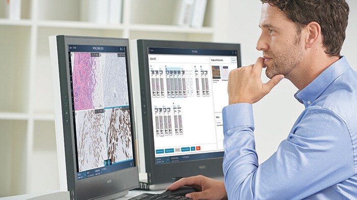 Philips e Ibex Medical Analytics se unen para acelerar la patología digital impulsada por IA