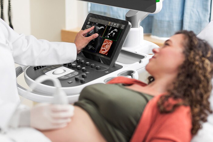 Download image (.jpg) Obstetrics ultrasound imaging shown on the EPIQ Elite