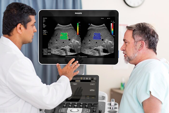 Download image (.jpg) (opens in a new window) Philips ultrasound systems EPIQ Elite and Affiniti for liver fat quantification