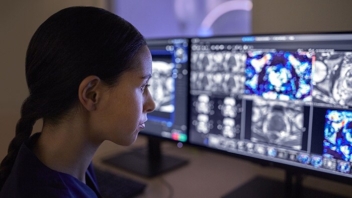 Philips presenta nuevas soluciones de radiología conectadas, inteligentes y escalables en RSNA 2021