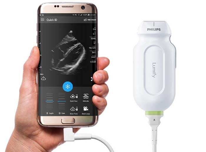 Download image (.jpg) (opens in a new window) Product shot of Philips Lumify handheld ultrasound