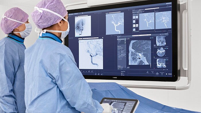Philips presenta sus últimos avances en la atención al ictus en el World Stroke Congress 2022