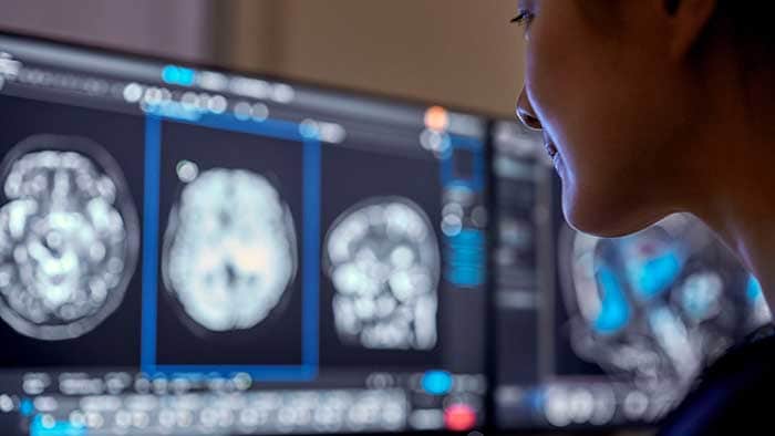 Philips incorpora la IA en la #RSNA23 para ayudar a los proveedores de atención médica a poder centrarse en la atención al paciente