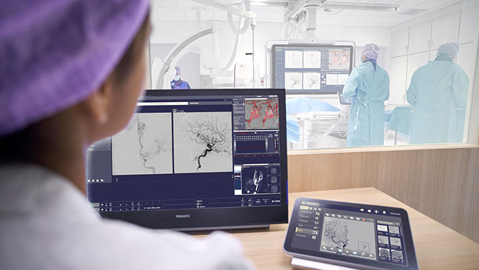 Philips stroke Azurion interventional suite -  