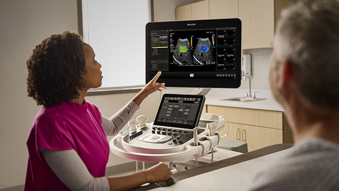 New automated workflow and quantitative measurement functions in ultrasound speed exams and increase clinical confidence -  
