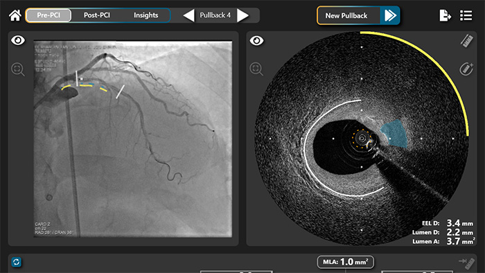 DeepOCT Enhanced Vascular Imaging -  