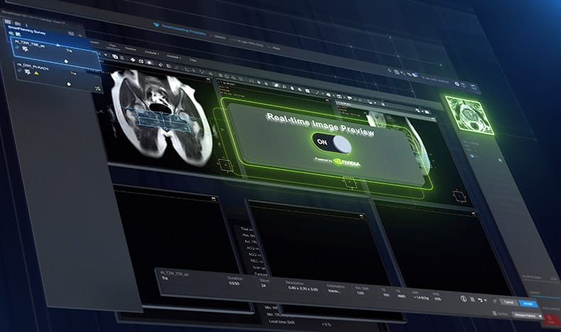 Philips x NVIDIA: predictive MRI image generation
