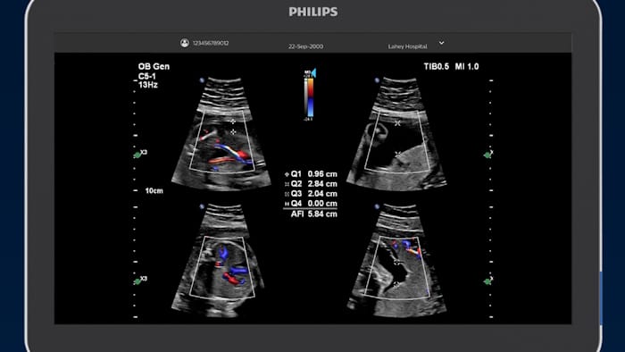 Philips Elevate Plus -  