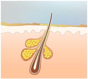 Dirt and dead skin cells cover the skin surface